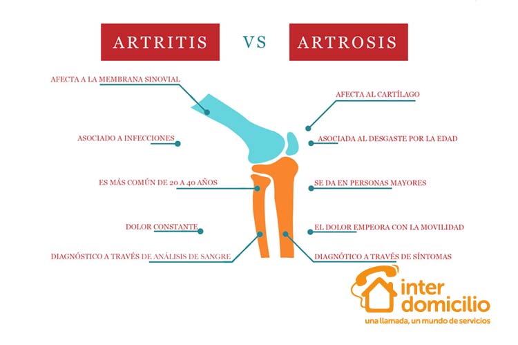 Diferencias entre artrosis y artritis